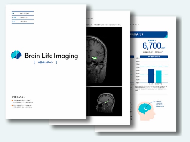 海馬を測定する「Brain Life Imaging®」とは